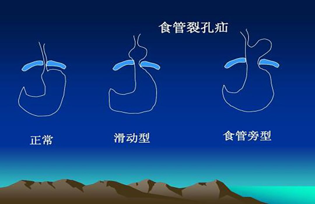 孕期的各种痛苦说说,孕期怎么缓解各类疼痛