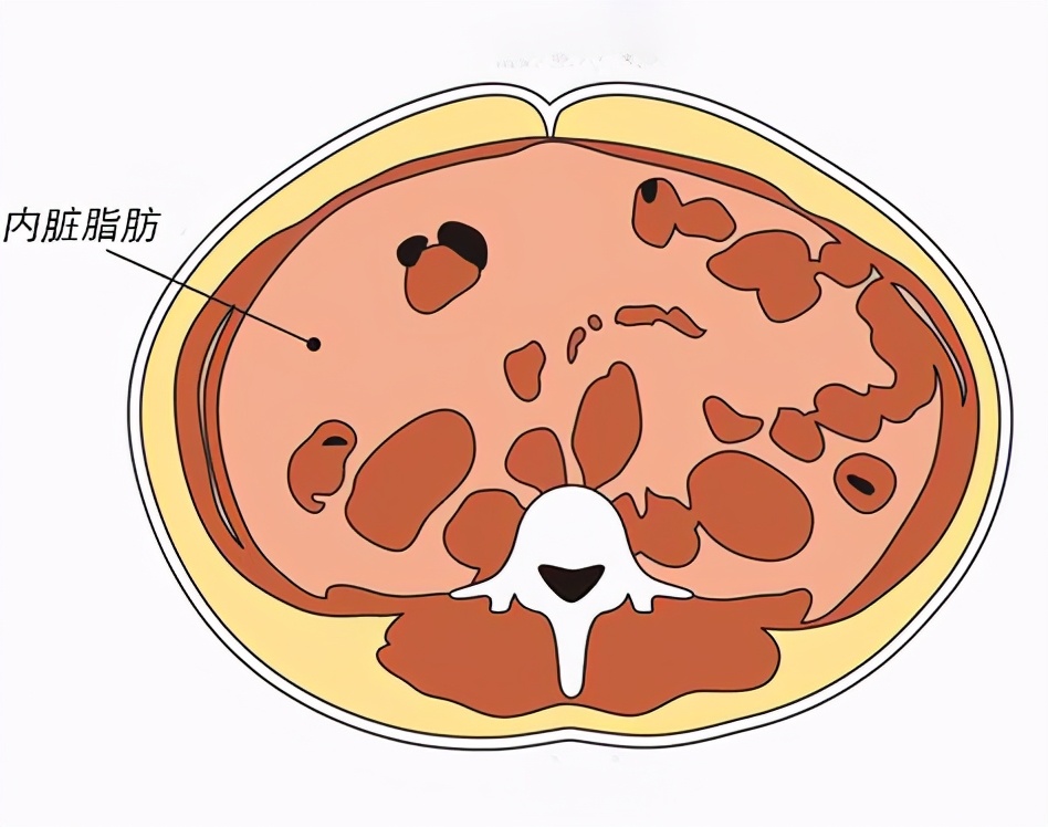 减内脏脂肪最有效的方法,内脏脂肪是在内脏里还是内脏表面