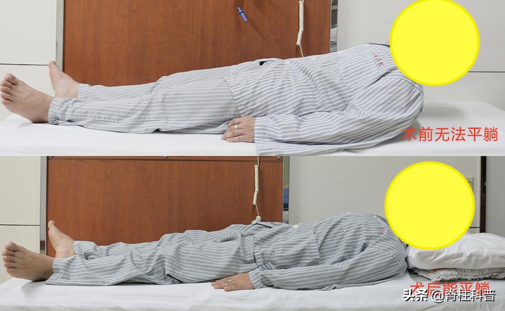 强直性脊柱炎患者免疫力低下吗,精神压力大导致强直性脊柱炎