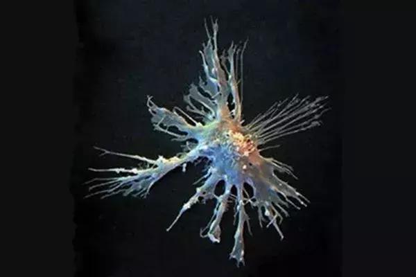 cns癌症免疫治疗的最新研究进展,全球免疫细胞治疗实体瘤发展现状