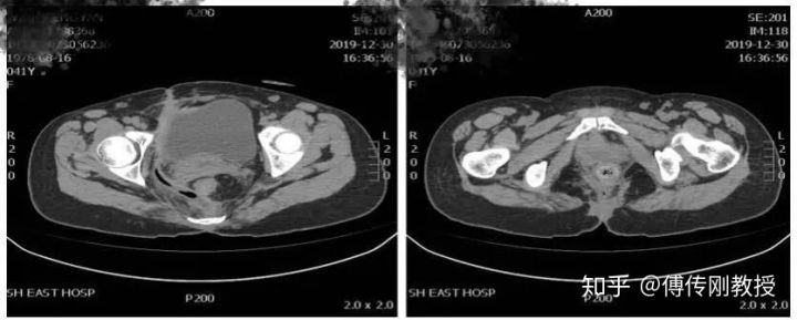 经历各种手术才活下来,经历了很多次手术