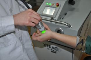 白癜风治疗之308nm准分子激光会出现的情况