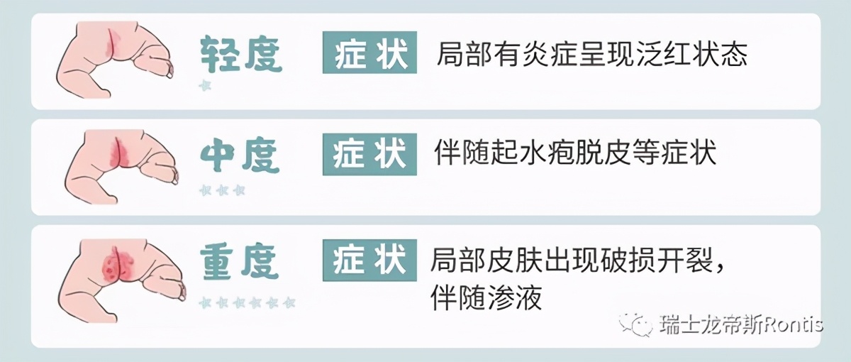 diaperrash护臀霜,防止宝宝红屁股用什么护臀霜