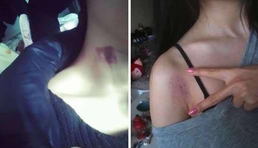 12岁女孩脖子印有“草莓”，家人痛心逼问，孩子的回答令人深思