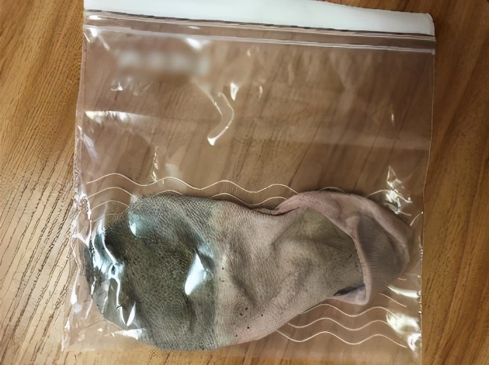 27岁男生脚臭,25岁帅哥脚臭怎么办