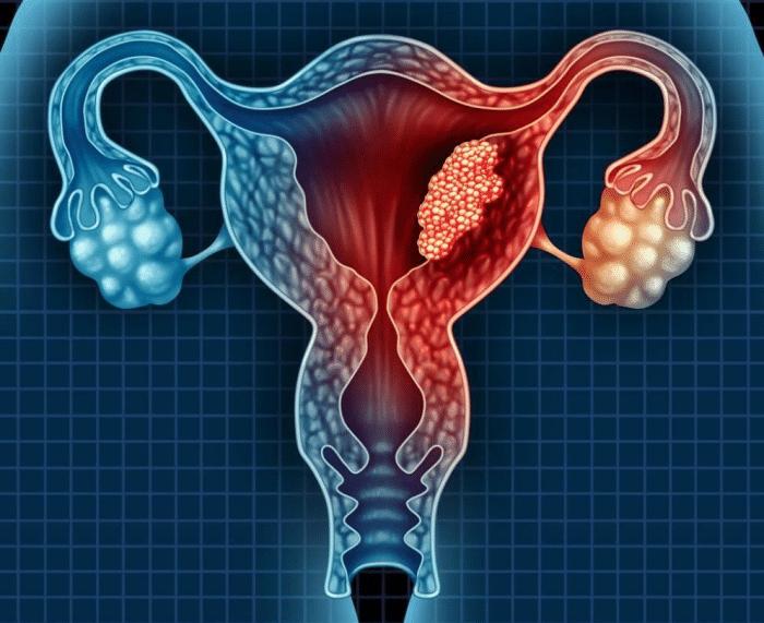 女子上了节育环会腰疼吗,女人上节育环会变胖吗