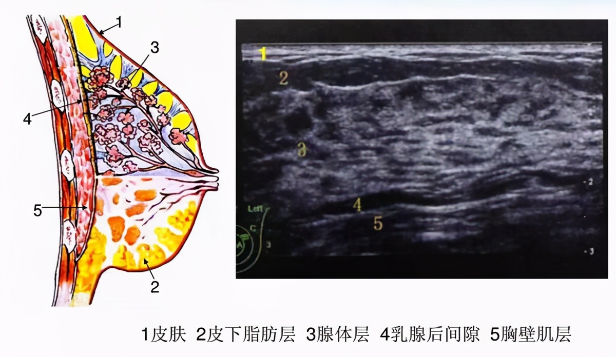 乳腺癌术后如何避免复发？呕血总结：乳腺手术的前世今生
