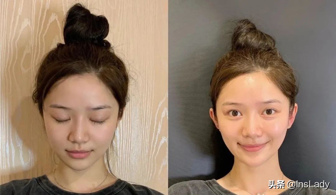 整容毁掉容貌的女子,一名女子整容却毁了她一生