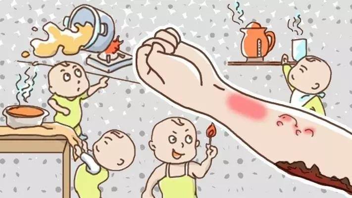 孩子被烫伤后期家长应该怎么处理,孩子烫伤后必须要做的五件事