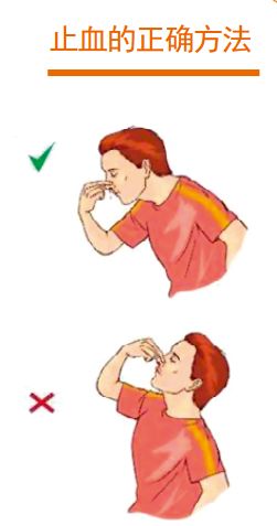 育儿|孩子流鼻血？你要知道的应急方法