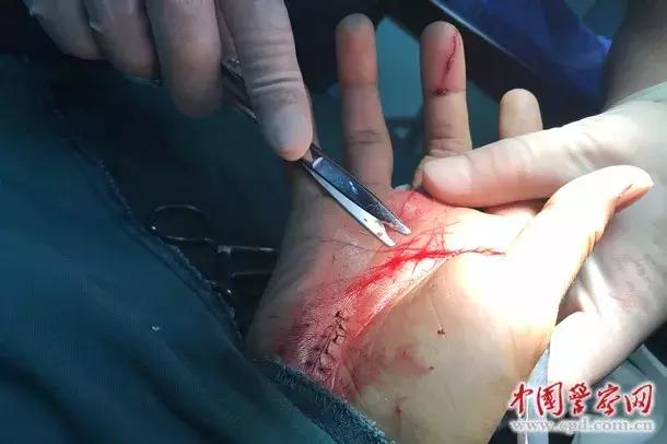 缉毒人员染艾滋病,缉毒警察感染艾滋病