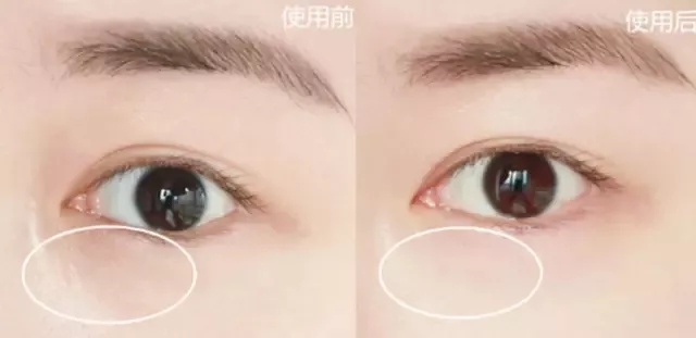 眼霜抗皱去细纹什么平价品牌最好,平价好用适合60岁妈妈用的眼霜