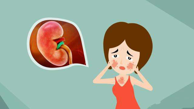 狼疮肾炎怎么保护肾,狼疮性肾炎患者如何更好地保护肾