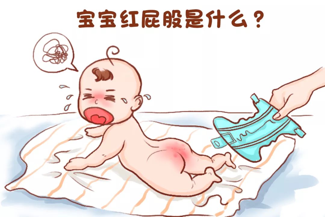 宝宝“红屁股”反反复复？别总让纸尿裤背锅，孕妈护理也有错