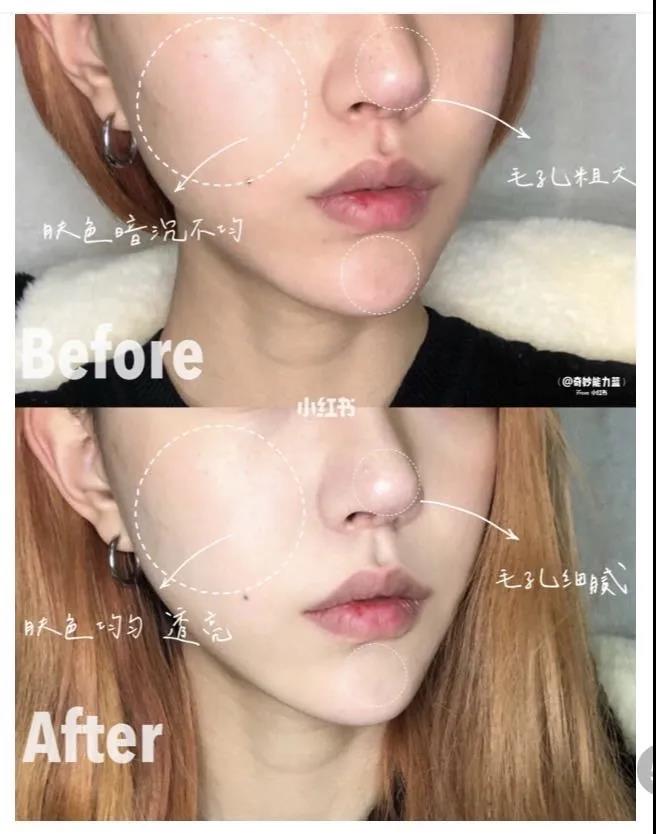 skii面膜推荐,skii的面膜好用吗