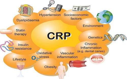 腰僵硬是强直性脊柱炎吗,腰部僵硬是强直性脊柱炎吗