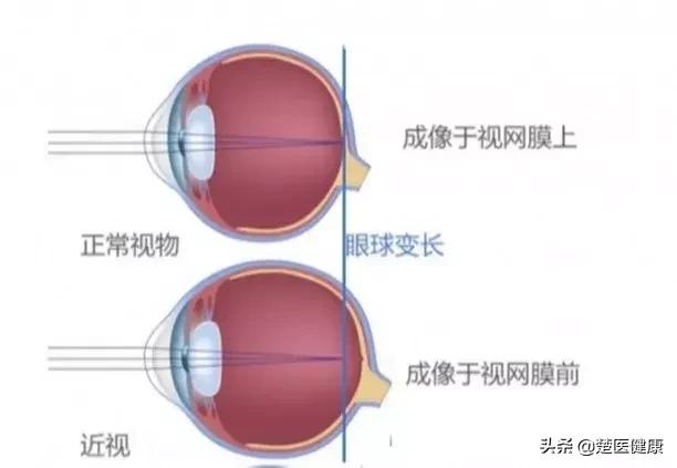 眼科激光手术靠谱吗,眼科医院近视矫正靠谱么