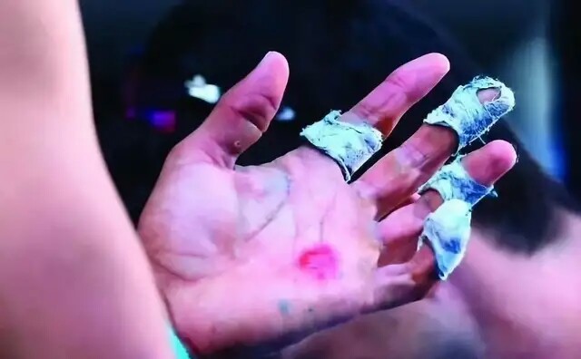 纳达尔的腿,纳达尔的手臂