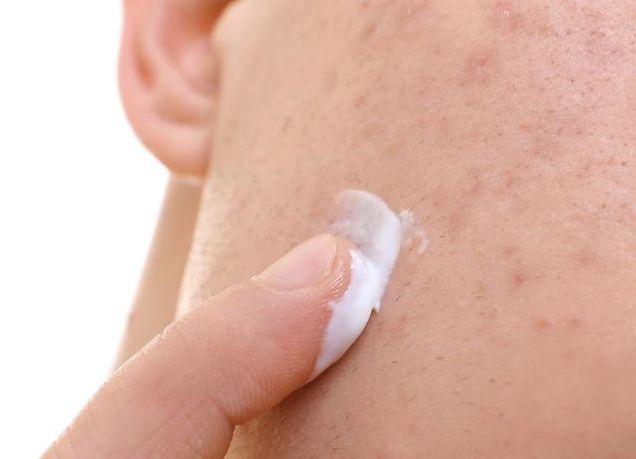 痘印黑色素沉淀怎么遮盖,痘印暗斑怎么快速消除