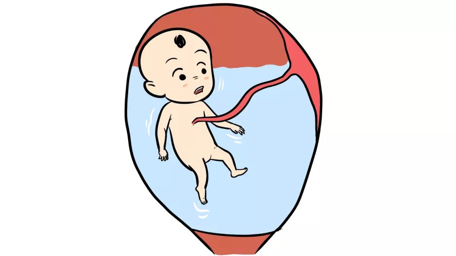 如何选择剖腹产和顺产？顺产好还是剖腹产好？最后怎么还是剖呢？