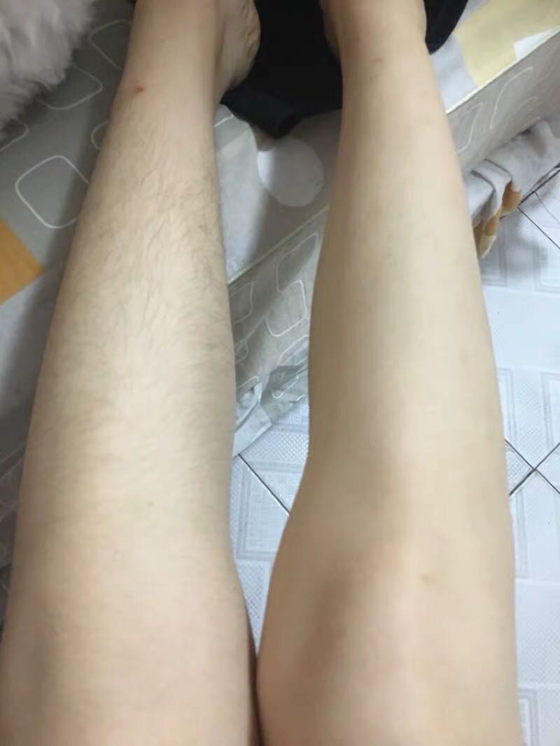 家用美容仪属于第几类,家用美容仪这个类目好做吗