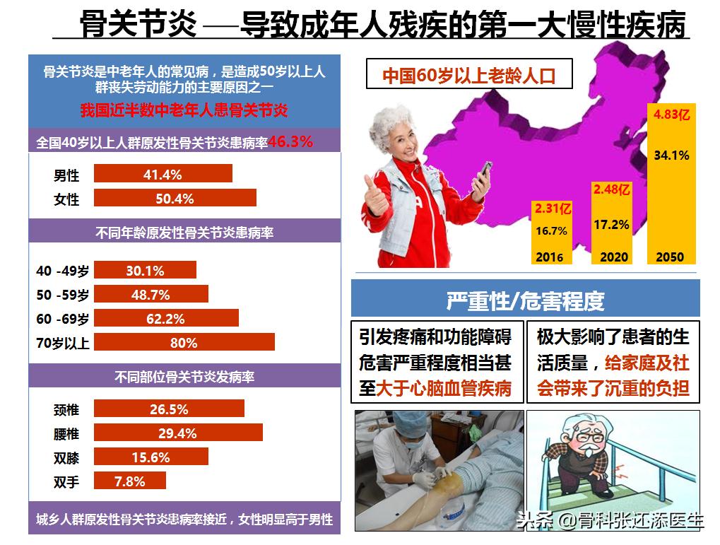 膝盖疼医生建议吃氨糖,医生告诉你膝关节疼痛的十大问题