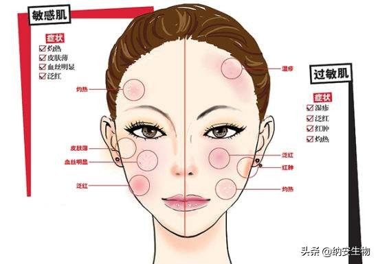 敏感肌肤该如何改善,如何了解自己是不是敏感肌肤
