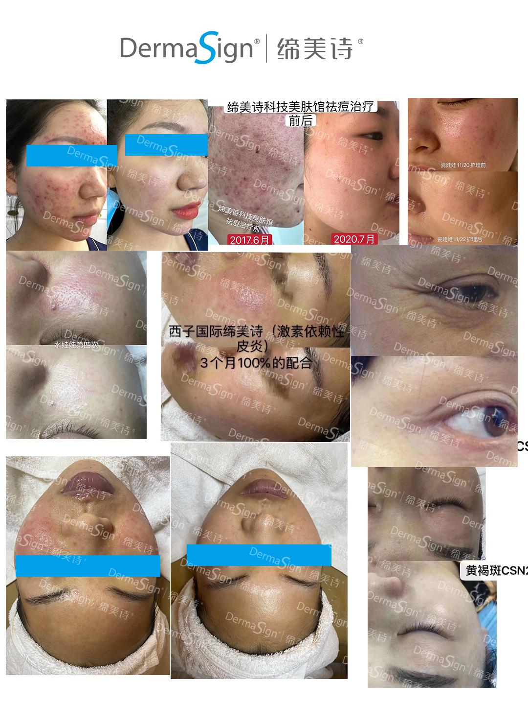 缔美诗是不是正规品牌,缔美诗护肤品效果怎么样