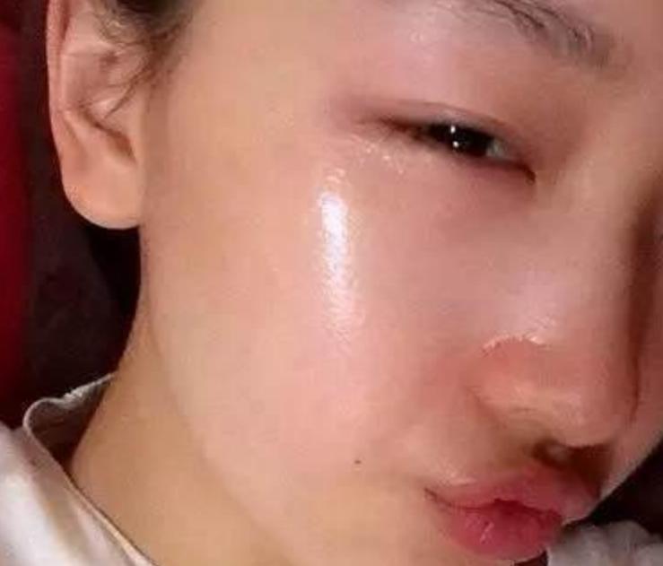 建议大家：睡前用妈妈们用的擦脸油，一点都不输国外大牌