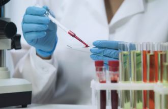 体检生化检测提示很多指标不正常,体检生化项目偏高怎么办