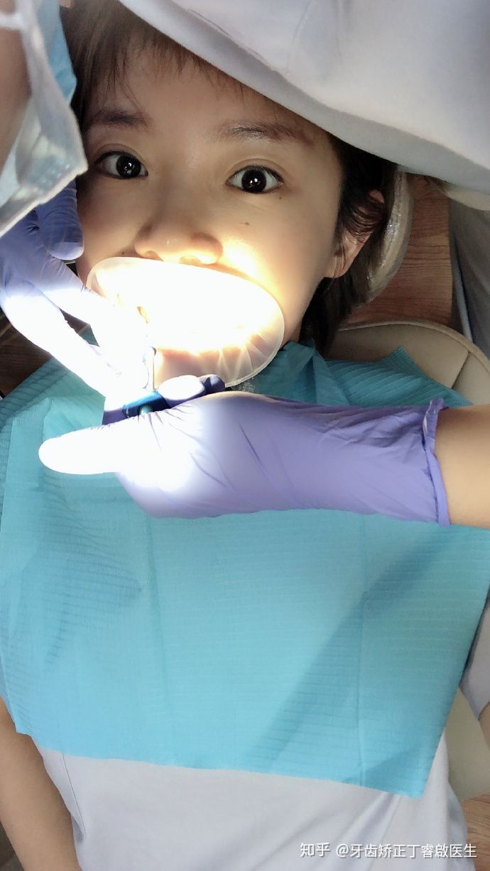 隐适美牙套矫正手法,隐适美牙套矫正的全过程