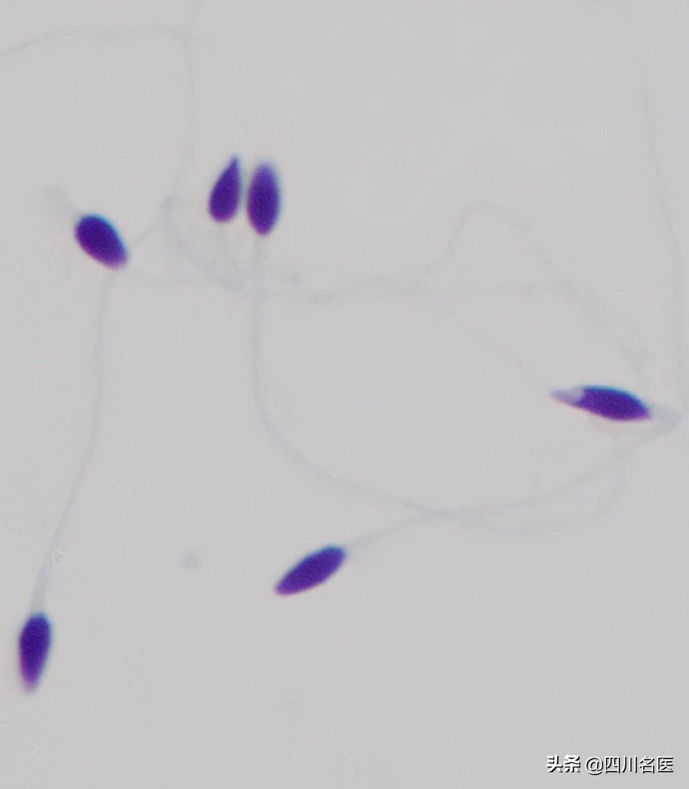 精子是如何产生的百科,精子是不是每天都能生成