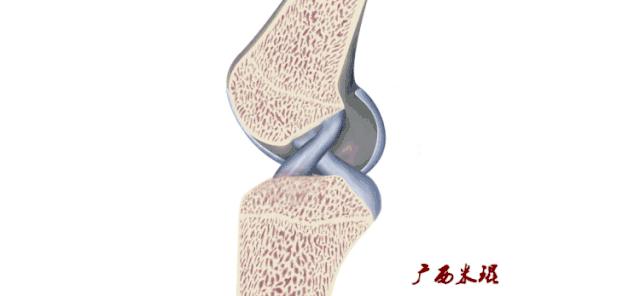 交叉韧带损伤的mr表现,后交叉韧带损伤的诊断实验