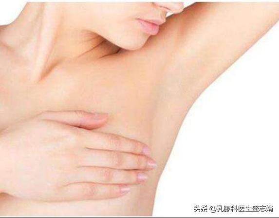 副乳要如何治疗？