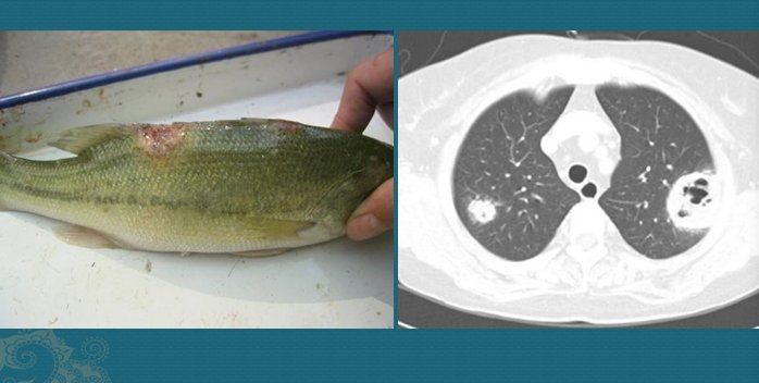 这个细菌提醒你，别买病死的鱼，它是个吃草的细菌，后来学会吃鱼