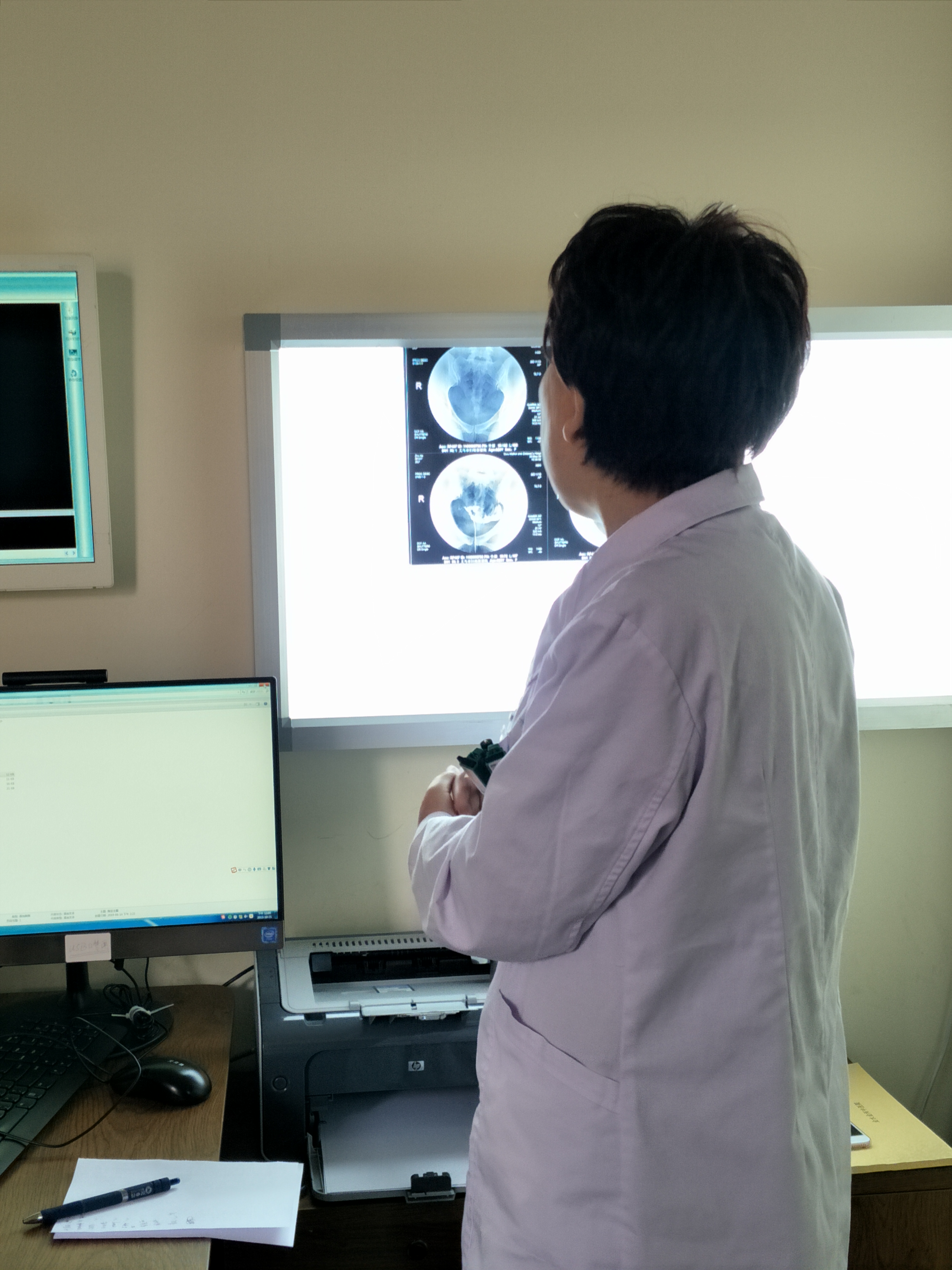 排卵试纸正常输卵管正常吗,附件正常说明输卵管正常吗