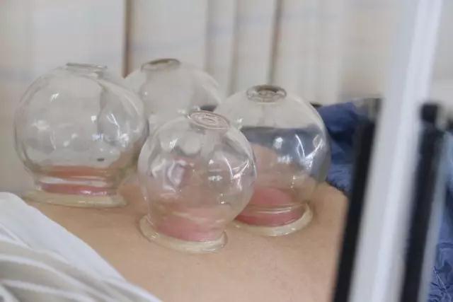 三伏天中医三伏贴,江苏省中医院可以预约三伏贴吗