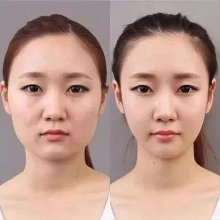 瘦脸脸大,脸大胖10斤这个方法瘦脸超有效