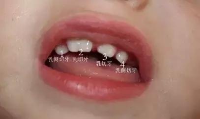 8岁宝宝牙齿长双排牙,1岁婴儿长双牙怎么办