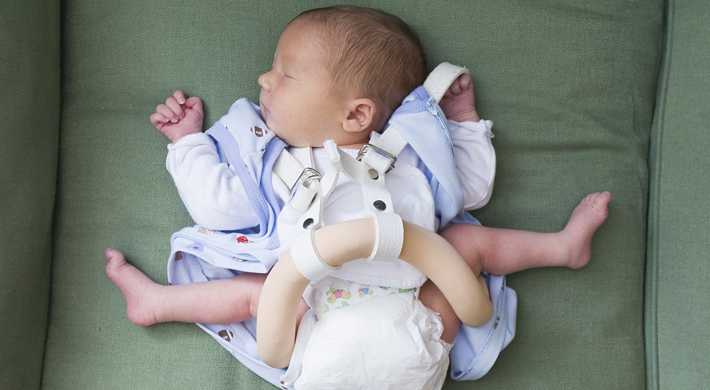 哪些小耳畸形患者无法进行耳畸形矫正手术