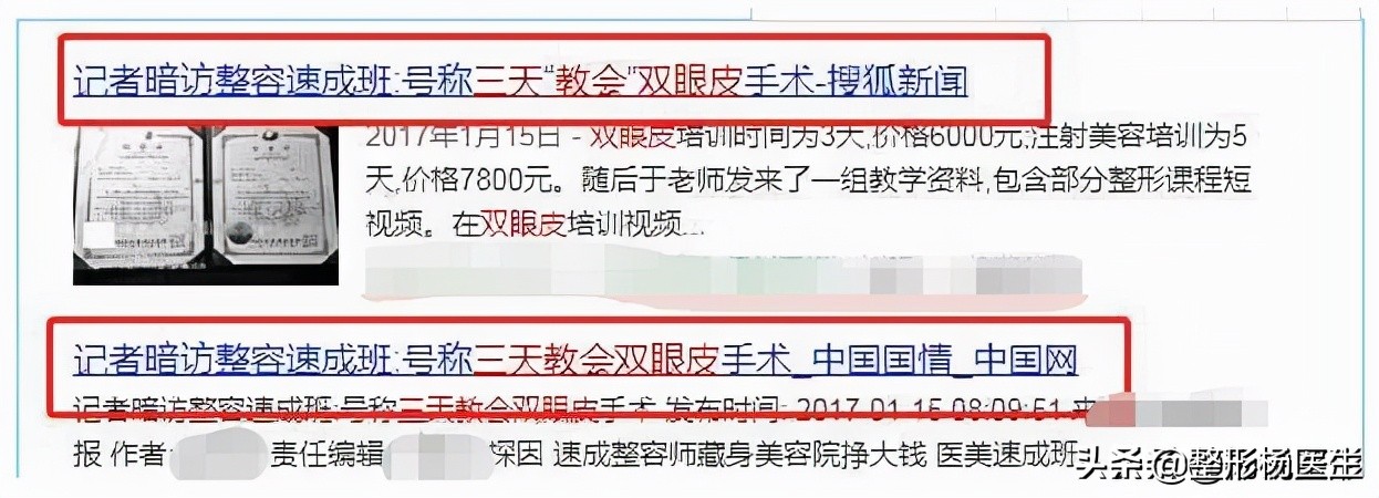 20岁面部凹陷如何改善,脂肪填充面部凹陷怎么导致的呢