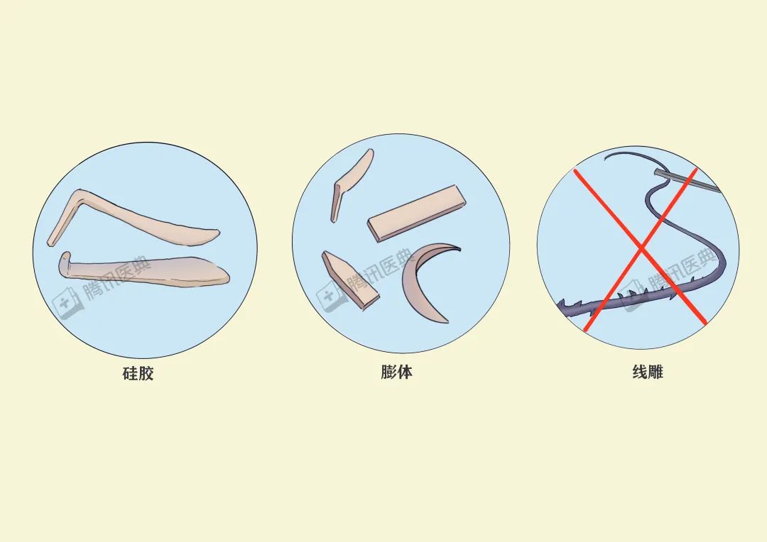 隆鼻的几大风险,隆鼻真的10个做9个后悔吗