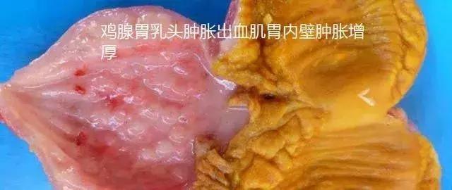 腺肌胃炎后期好治吗,腺肌胃炎最佳治疗方法