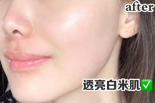 美白祛黄提亮肤色泡水喝,每天喝一杯可以美白淡斑清热解毒