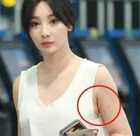 超模收副乳,超模消除副乳
