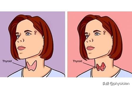 腹痛拉肚子是怎么回事要吃什么药,拉肚子拉绿色的是什么病吃什么药