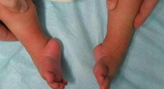 足脊健康知识视频讲解,足脊健康小讲座