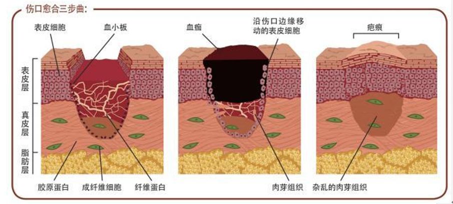 祛痣后吃了辣椒和牛羊肉,祛痣后吃了酱油和姜怎么办