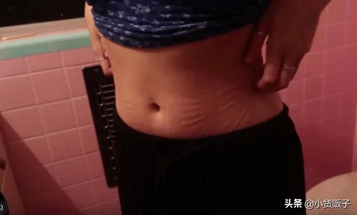 内脏下垂、子宫脱落、漏尿…今天和你一起说一说束腰的危害