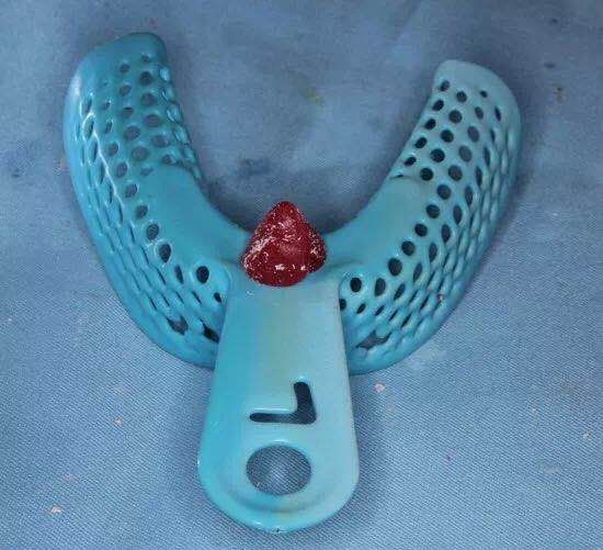 咬合重建详细步骤,如何制作咬合模型